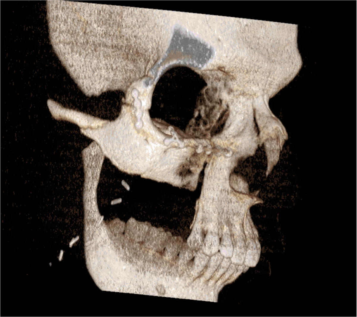 Fig. 2 Refer to the following caption and surrounding text.