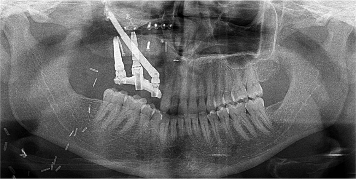 Fig. 4 Refer to the following caption and surrounding text.