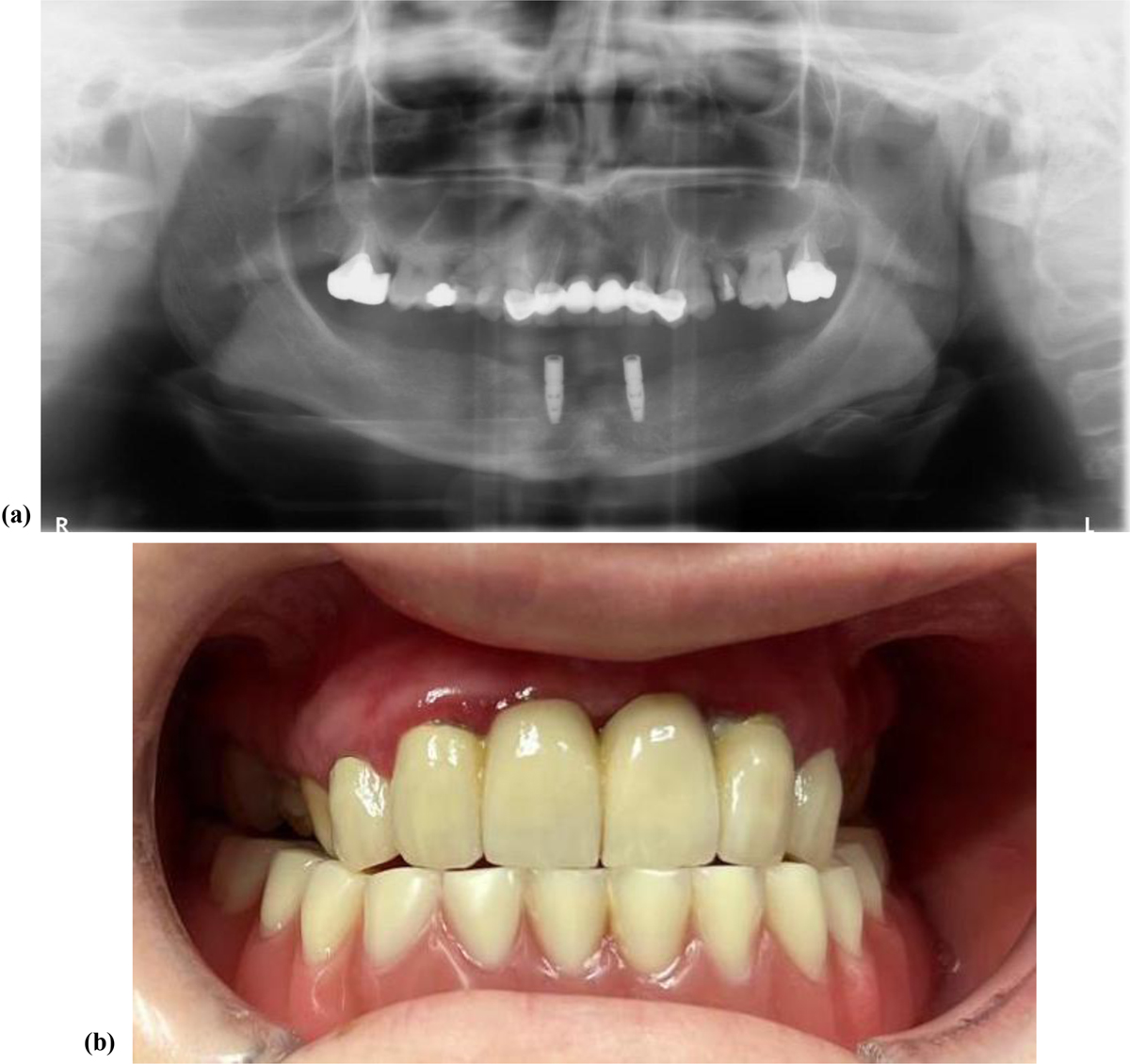 Fig. 2 Refer to the following caption and surrounding text.