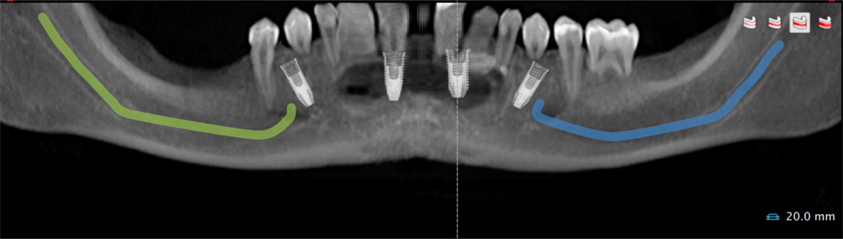 Fig. 6 Refer to the following caption and surrounding text.