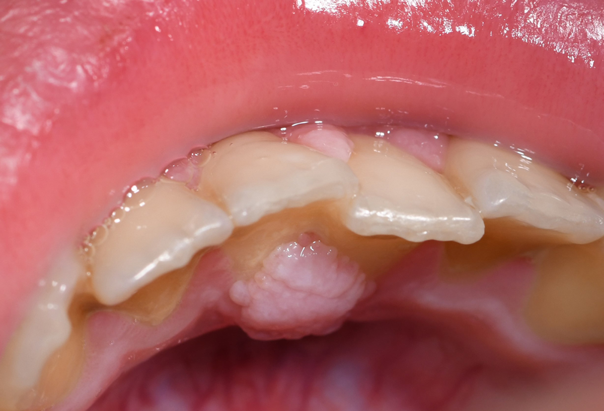 Fig. 1 Refer to the following caption and surrounding text.