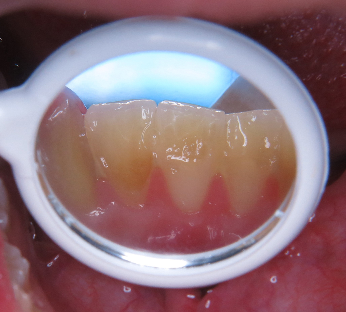 Fig. 2 Refer to the following caption and surrounding text.