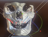 Thumbnail: Fig. 1 Refer to the following caption and surrounding text.
