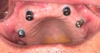 Thumbnail: Fig. 4 Refer to the following caption and surrounding text.