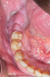 Thumbnail: Fig. 1 Refer to the following caption and surrounding text.