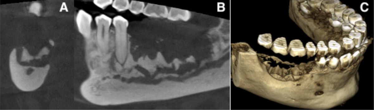 Fig. 2 Refer to the following caption and surrounding text.