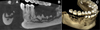 Thumbnail: Fig. 2 Refer to the following caption and surrounding text.