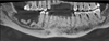 Thumbnail: Fig. 3 Refer to the following caption and surrounding text.