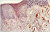 Thumbnail: Fig. 2 Refer to the following caption and surrounding text.