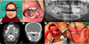 Thumbnail: Fig. 2 Refer to the following caption and surrounding text.